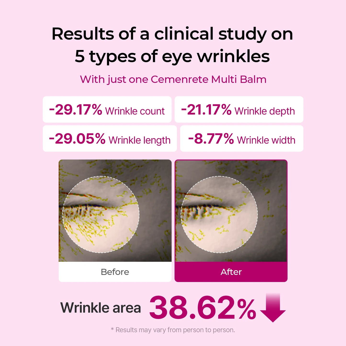 Cemenrete Calcium Dark Spot Eye Cream