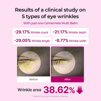 Cemenrete Calcium Dark Spot Eye Cream